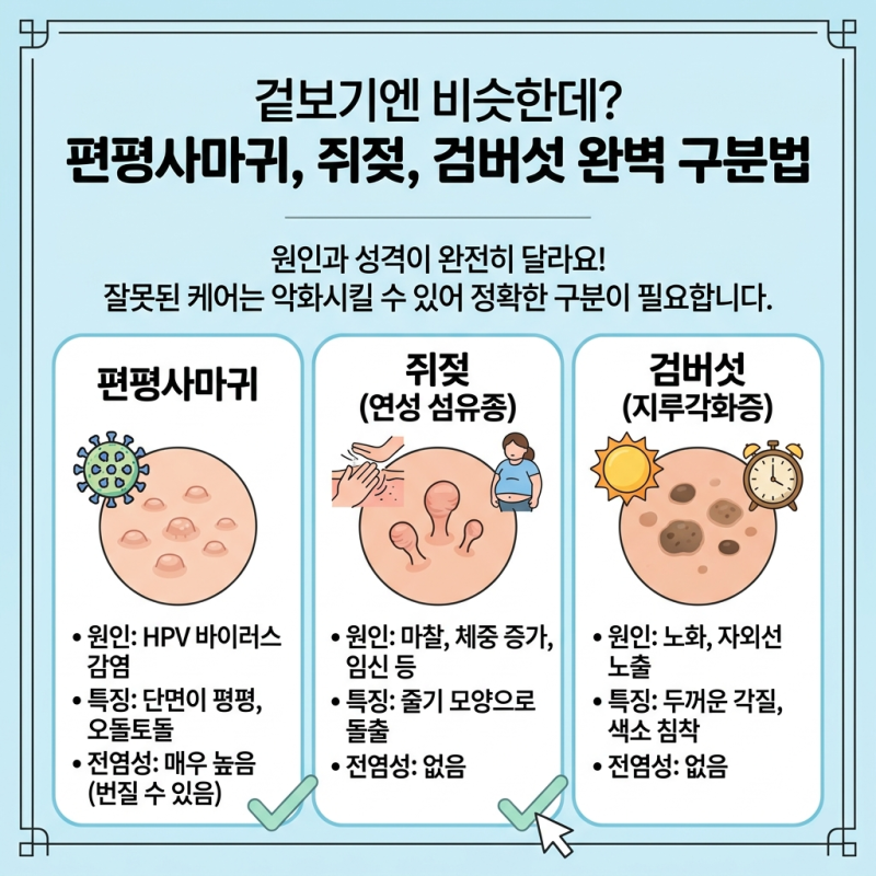 잠실 편평사마귀 치료 한의원, 쥐젖·검버섯 차이점과 편평사마귀를 방치하면 안 되는 이유 [....
