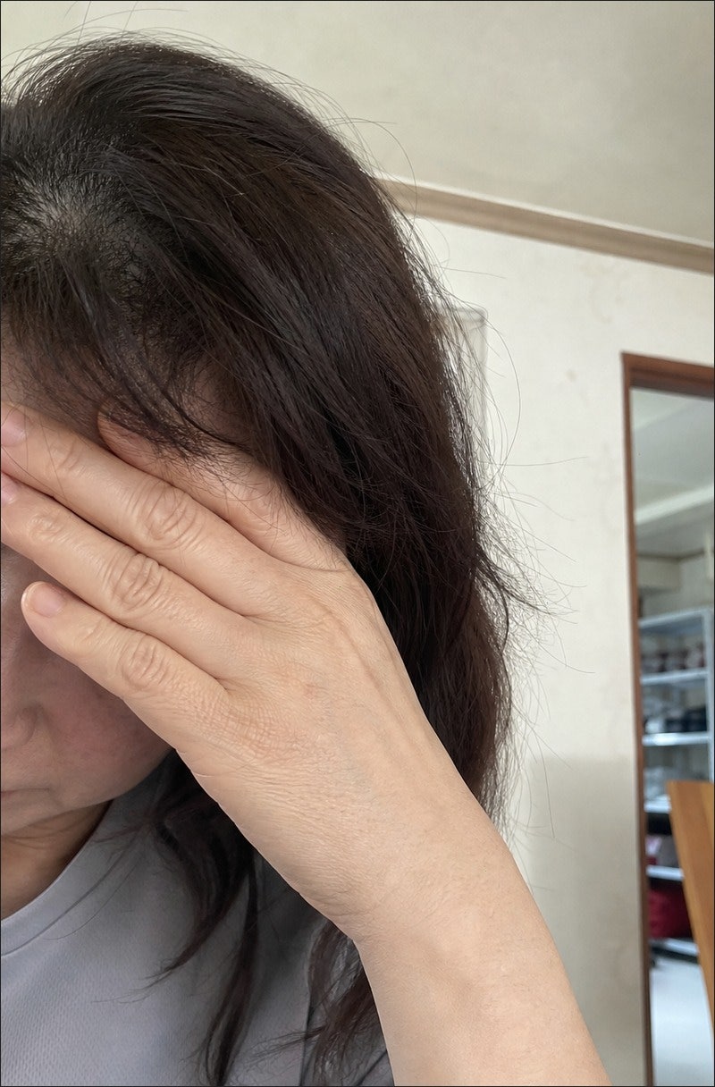 헤어메스마그네슘 두 달 챙겨보고 진짜 경악했어요