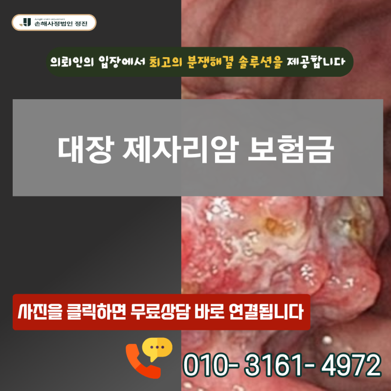 대장 제자리암 보험금 D01 코드인데 왜 10%만 지급될까? 전액 수령 비결은?