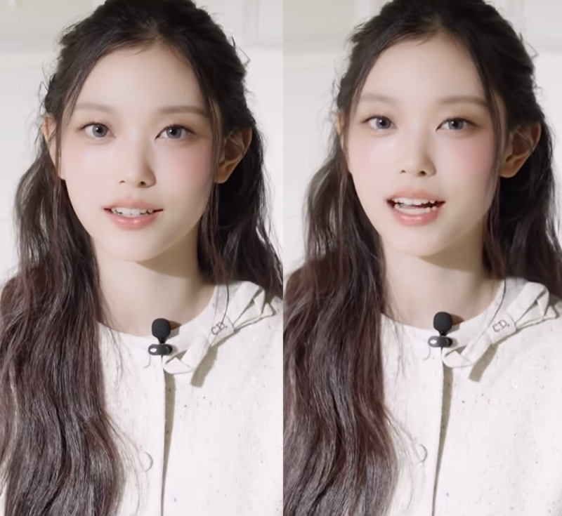 뉴진스 해린 송곳니 다시 나타난 이유, 라미네이트 제거가 아니라 '이것' 때문이다