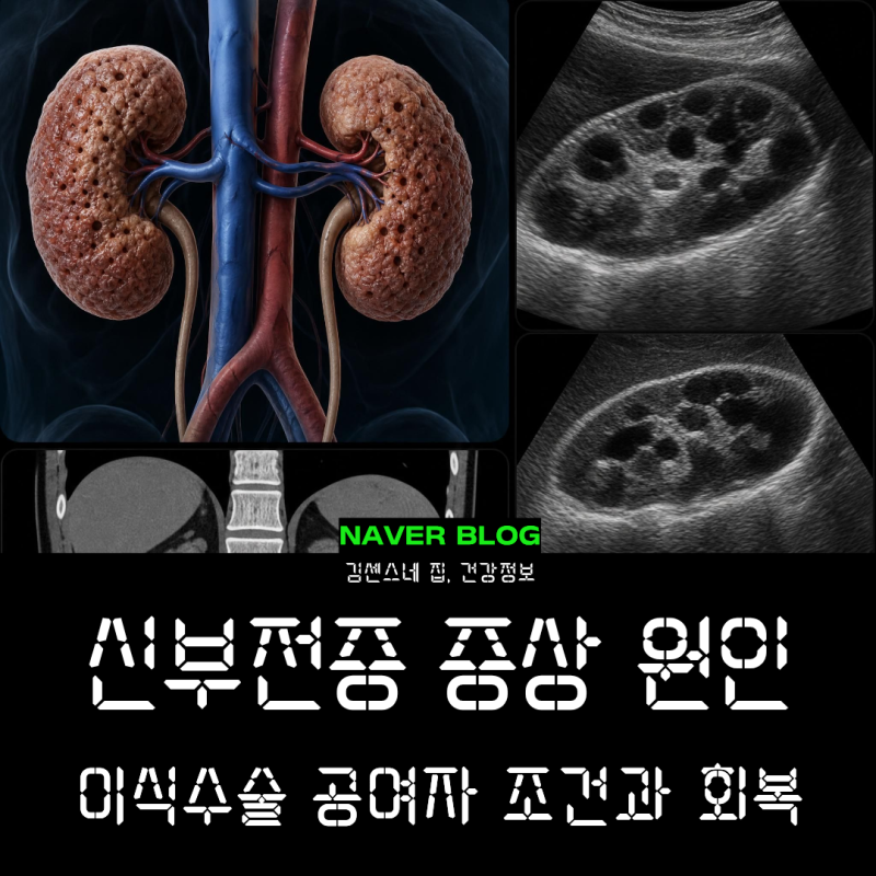 신부전증 증상 원인; 신장이식 공여자 조건 및 회복기간