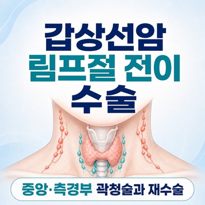 2026 갑상선암 림프절 전이 수술 총정리｜중앙·측경부 곽청술과 재수술