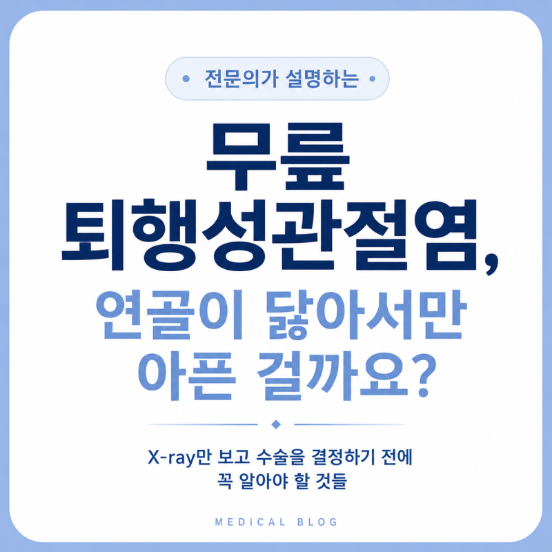 4-1. 무릎 퇴행성관절염, 연골이 닳아서만 아픈 걸까요?