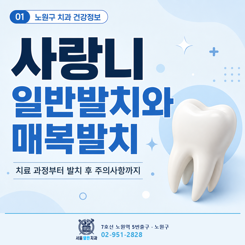 사랑니 일반발치와 매복발치 치료 과정, 발치 후 주의사항까지