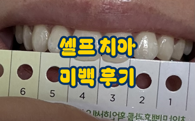 셀프 치아 미백 후기 (페리오 화이트 나우 미백 패치/올리브영 치아미백/누렁니/누런니/내돈....