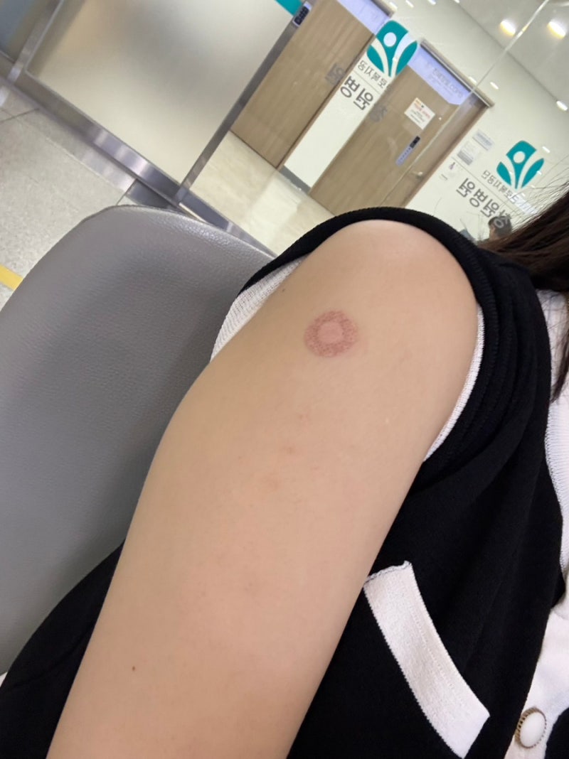 창원 백일해 주사 어디서 맞을까? 가장 저렴한 근로복지공단 창원병원 접종 절차 및 비용