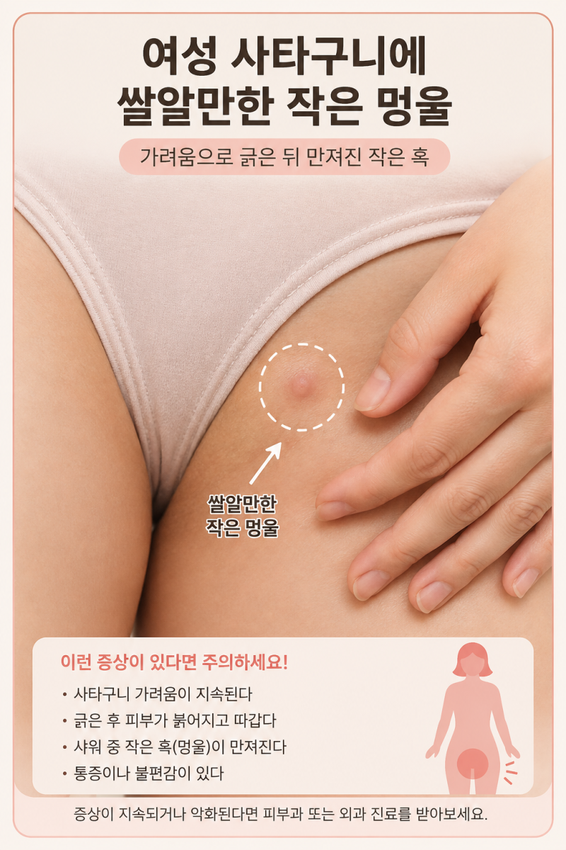 여름철 사타구니 멍울(혹), 단순한 땀띠일까? 가려움에서 시작된 작은 혹