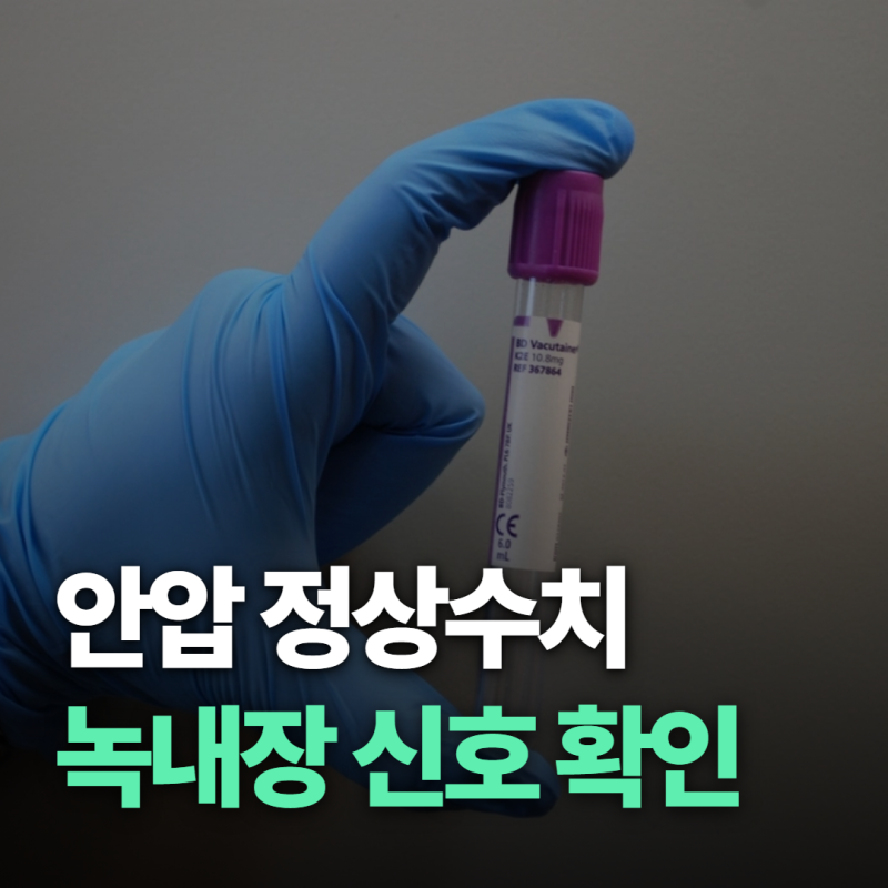 "눈이 뻑뻑하고 두통이 잦다면" 녹내장 안압 정상수치 확인법 5가지