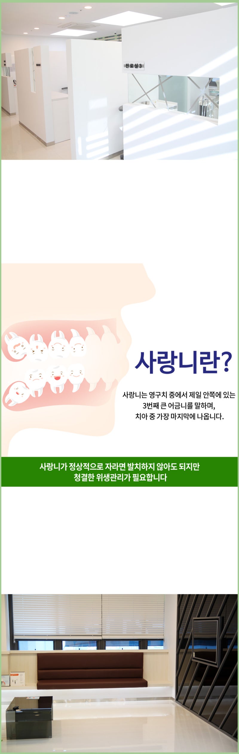 전주 사랑니발치 한 번에 양쪽 다 뽑아도 괜찮을까요?