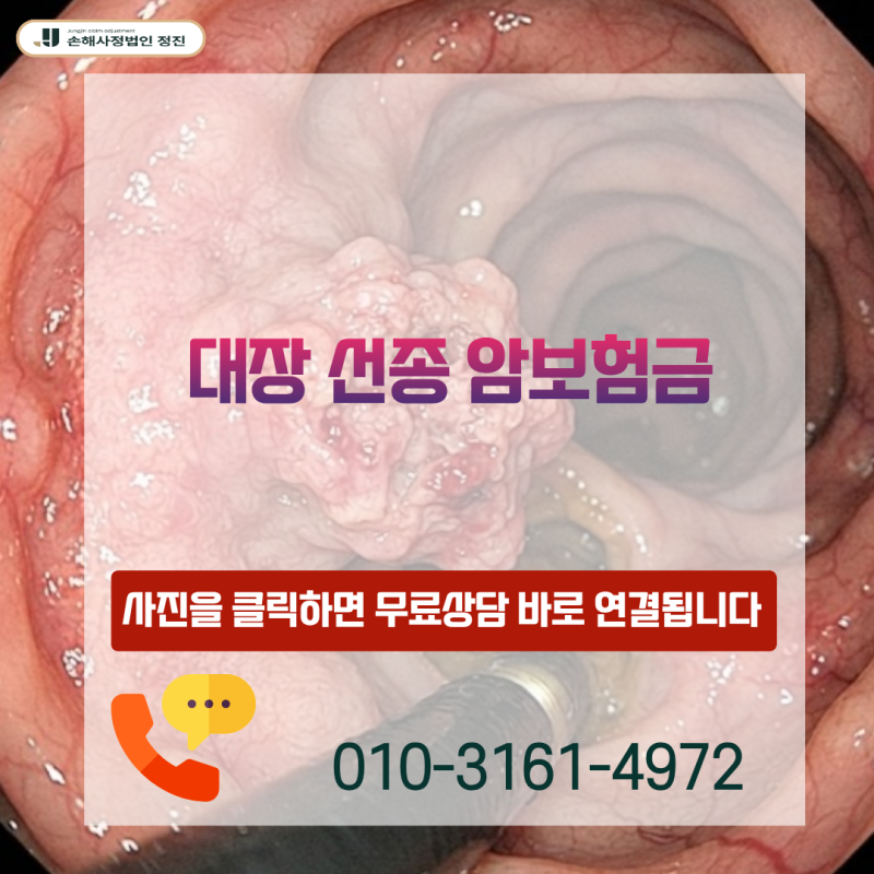 대장 선종 암보험금, D12·D01 코드 받고도 일반암 전액 지급 가능할까?