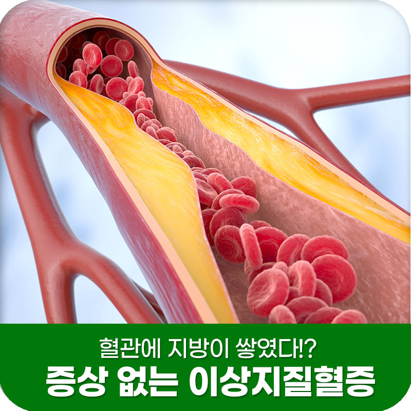 혈관에 지방이 쌓였다!? 증상 없는 이상지질혈증, 괜찮을까요?