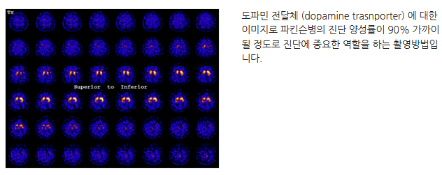 파킨슨증후군(MSA-C) 초기증상 및 진단검사들