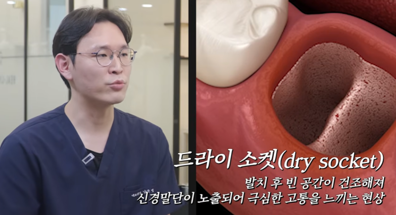 홍대 사랑니｜치과의사가 직접 읽어주는 사랑니 발치 후 주의사항