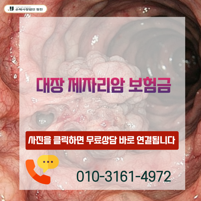 대장 제자리암 보험금, D01 코드 받고도 100% 전액 수령 가능한 이유는 무엇일까?