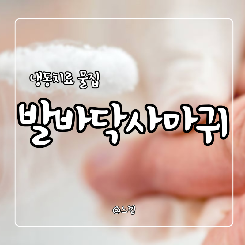 발바닥 사마귀 재발 냉동치료 후 물집