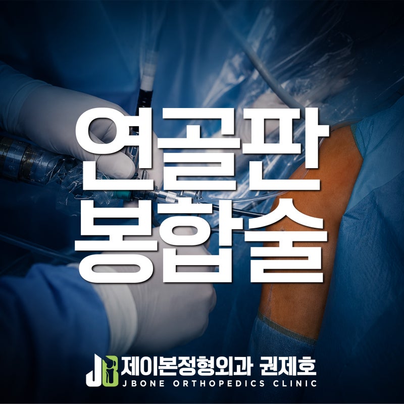 반월상연골판파열, 농구하다 외측 연골판이 복합 파열된 30대 남성