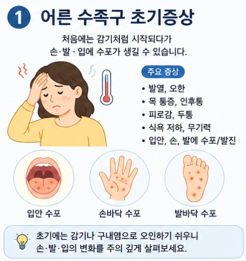 어른 수족구 초기증상은? 아이에게 옮았을 때 전염기간·격리기간과 회사 출근