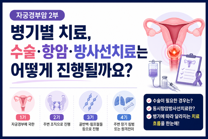 자궁경부암 2부｜병기별 치료, 수술·항암·방사선치료는 어떻게 진행될까요?