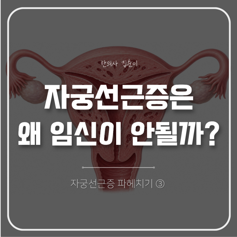 자궁선근증이 있으면 왜 임신이 잘 안 될까?