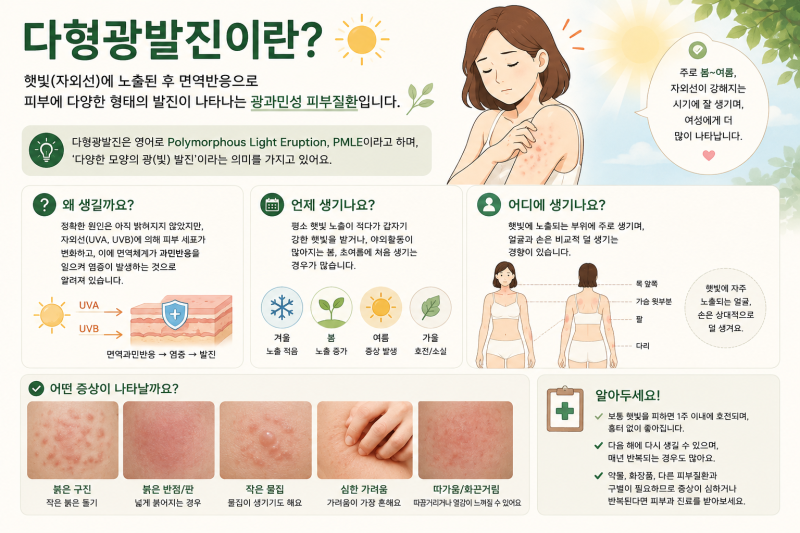 "해만 쬐면 붉어지는데...흔한 햇빛 알러지가 아니라고?" '다형광발진' 제대로 알고 핵심 관리....