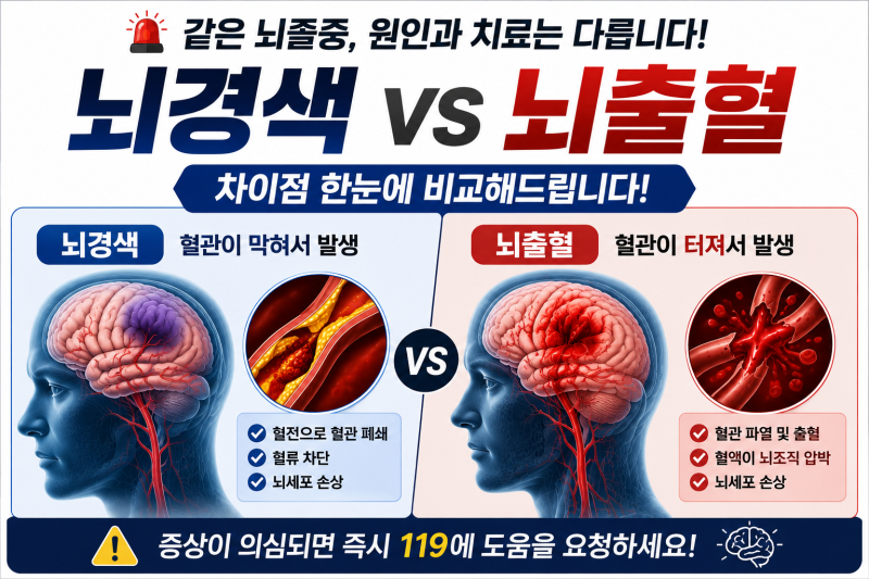 뇌경색과 뇌출혈 차이, 같은 뇌졸중이지만 치료가 다른 이유는 ??