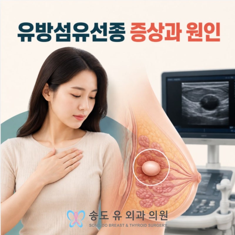 유방섬유선종 증상과 원인, 크기가 커지면 제거해야 할까요?
