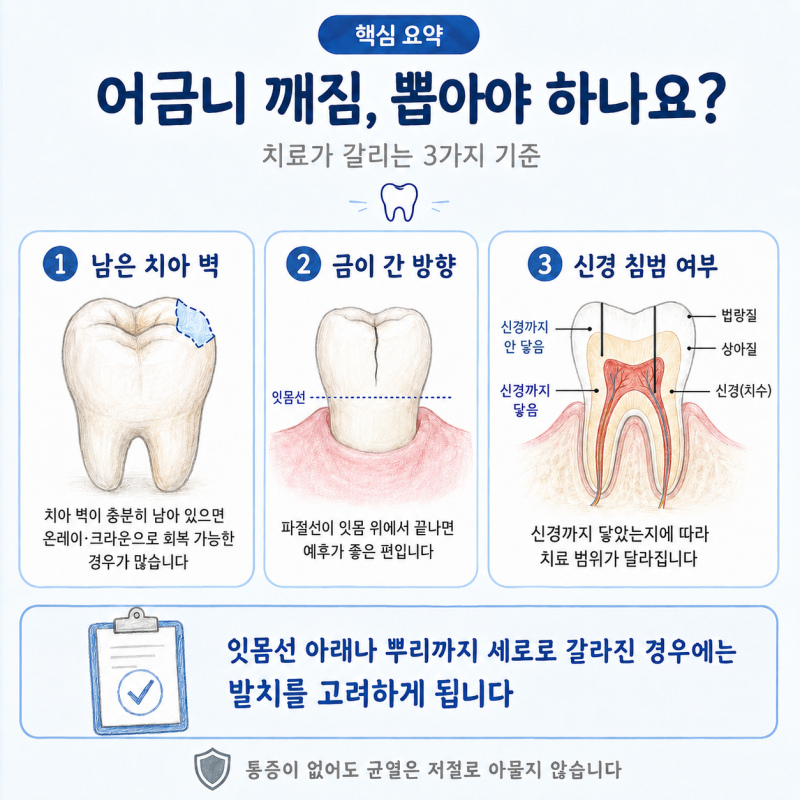 어금니 깨짐, 뽑아야 하나요? 치료가 갈리는 3가지 기준