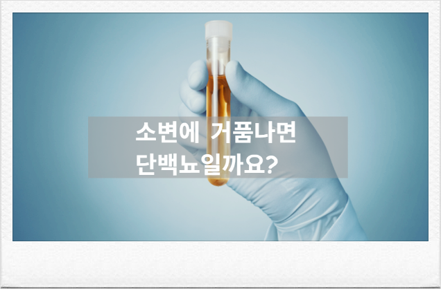 소변에 거품이 몽글몽글? 단백뇨 증상부터 신장학회 기준 검사법까지 완벽 가이드