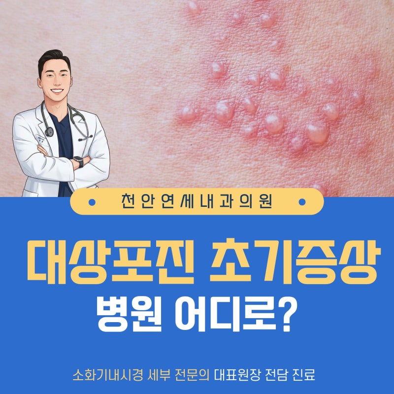 천안 대상포진, 병원 어디로 가야 할까요? 초기 증상부터 치료까지