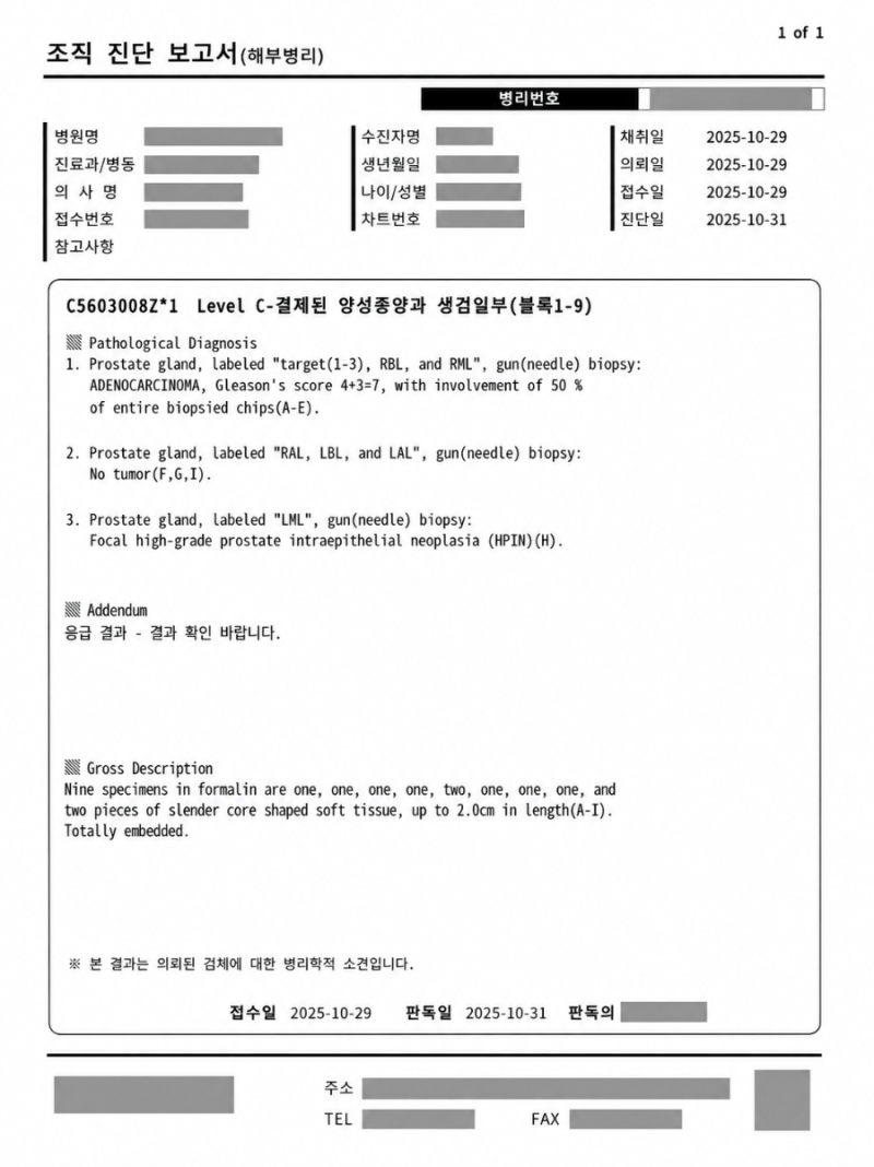 조직검사 결과 글리슨 4+3=7, 그리고 상급병원 진료
