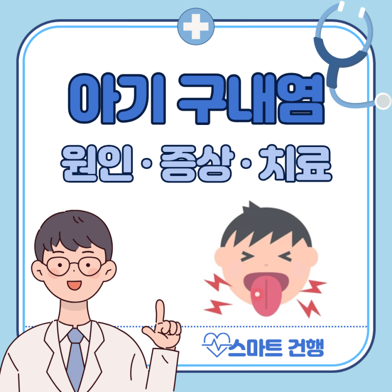 아기 구내염 원인, 전염성, 증상, 약국 연고 약