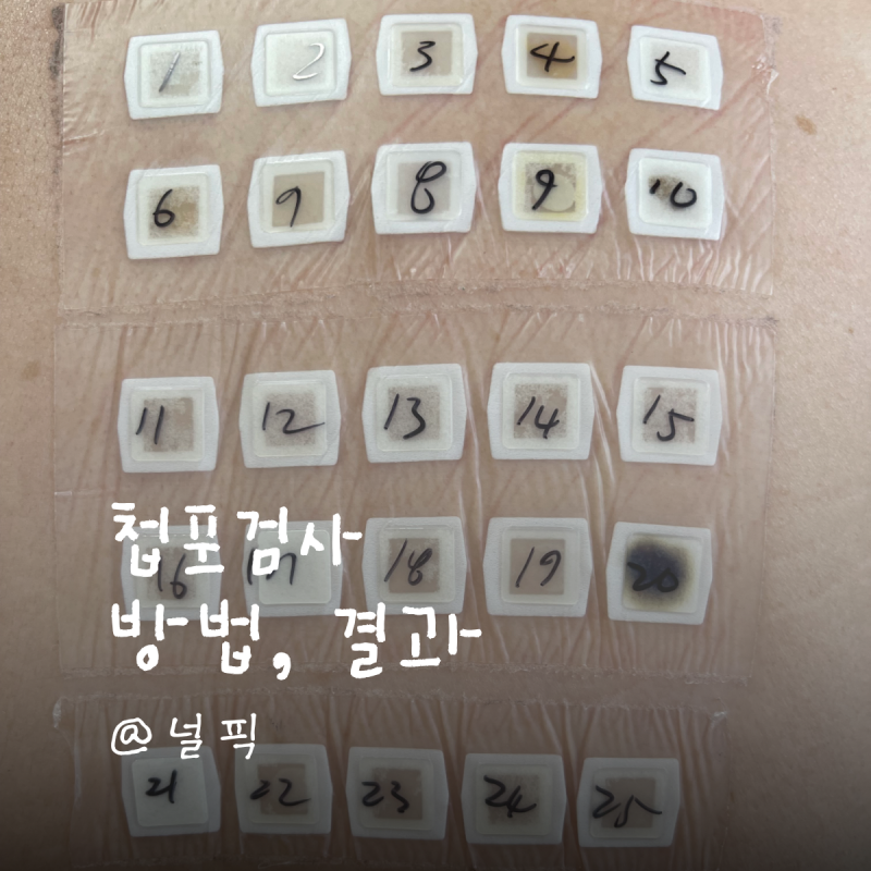 피부 지연성 알레르기 원인 찾기, 첩포검사(Patch Test) 방법 반응 후기 결과 총정리