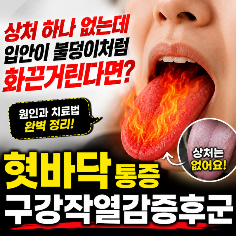혓바닥통증 원인 (+구강작열감증후군, 치료법) - 상처 하나 없는데 입안이 불덩이처럼 화끈거....