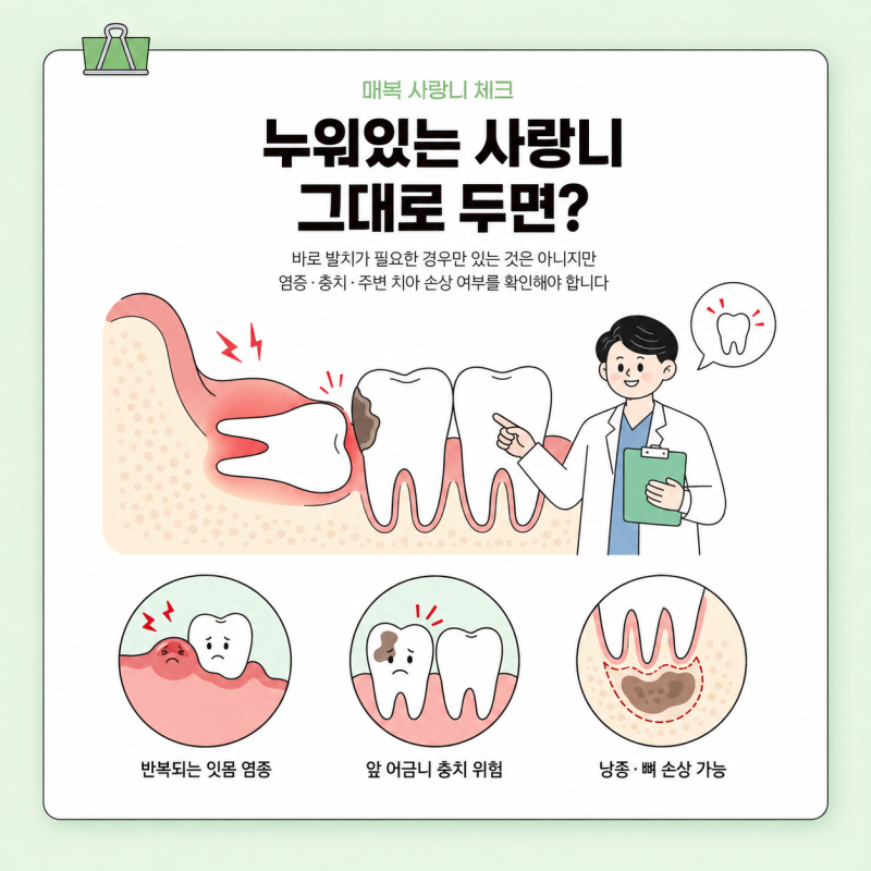 누워있는 사랑니 발치 안하면 어떻게될까? 실제 발치 과정과 통증은 얼마나 심할까?