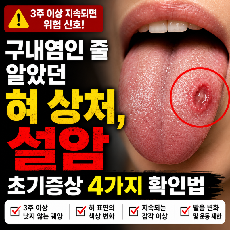 구내염 아닌 설암 초기증상 혀 상처 3주 지속된다면