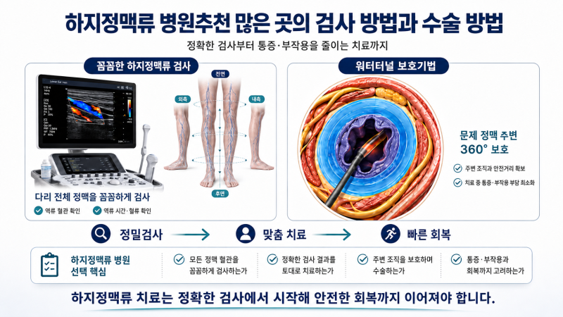 하지정맥류 병원추천 많은 곳의 검사 방법과 수술 방법