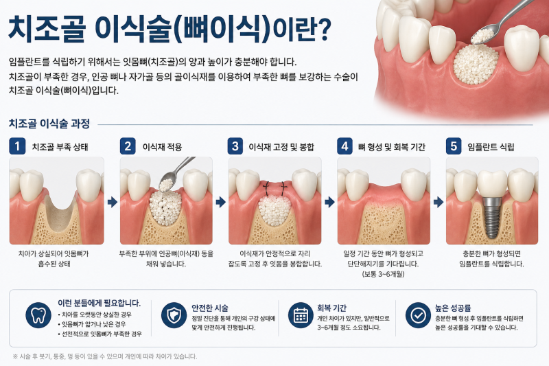 임플란트 뼈이식, 2종 수술비 청구가 가능할까요?