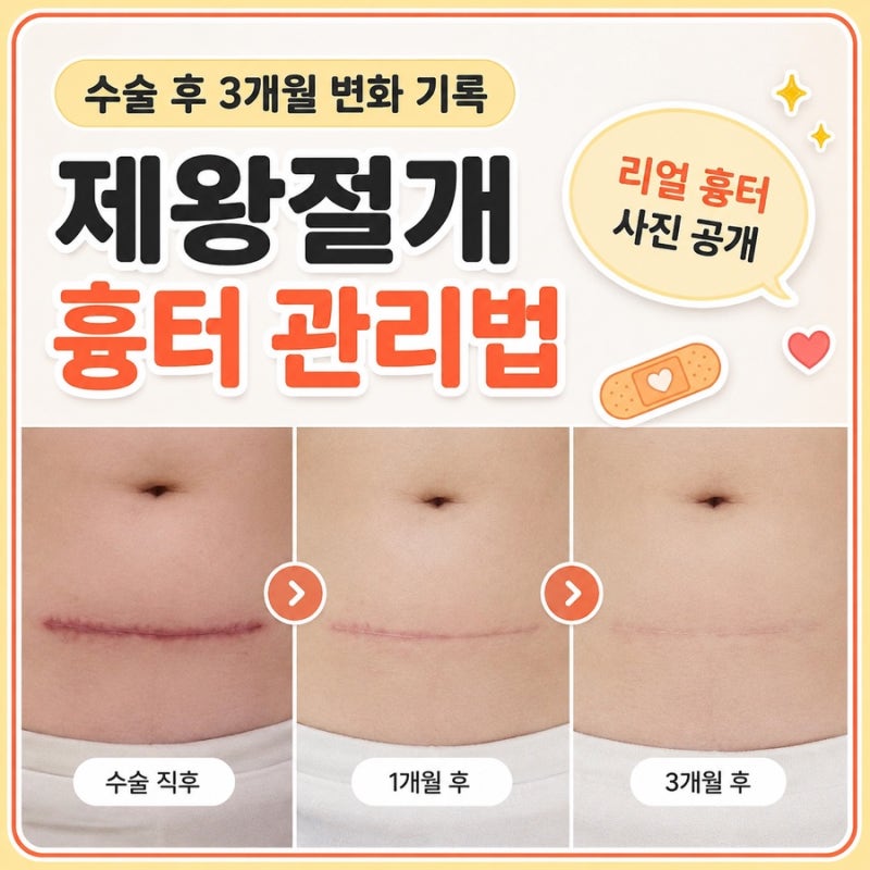 제왕절개 흉터 관리법｜수술 후 3개월 실제 상처 변화·연고 밴드 사용시기 (흉터사진有)