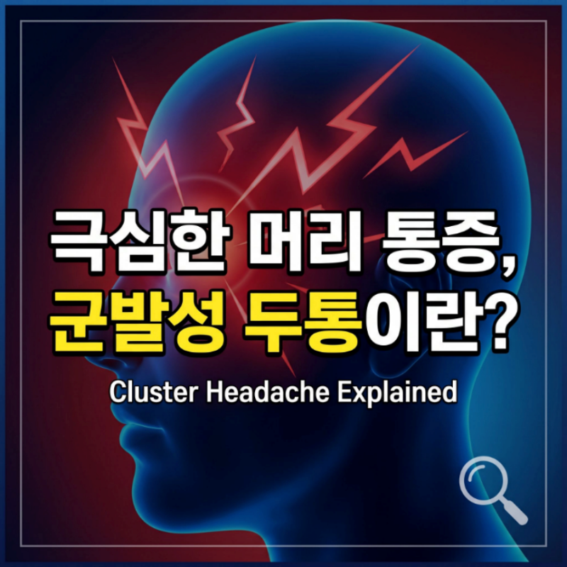 군발성 두통 원인 증상, 편두통 차이