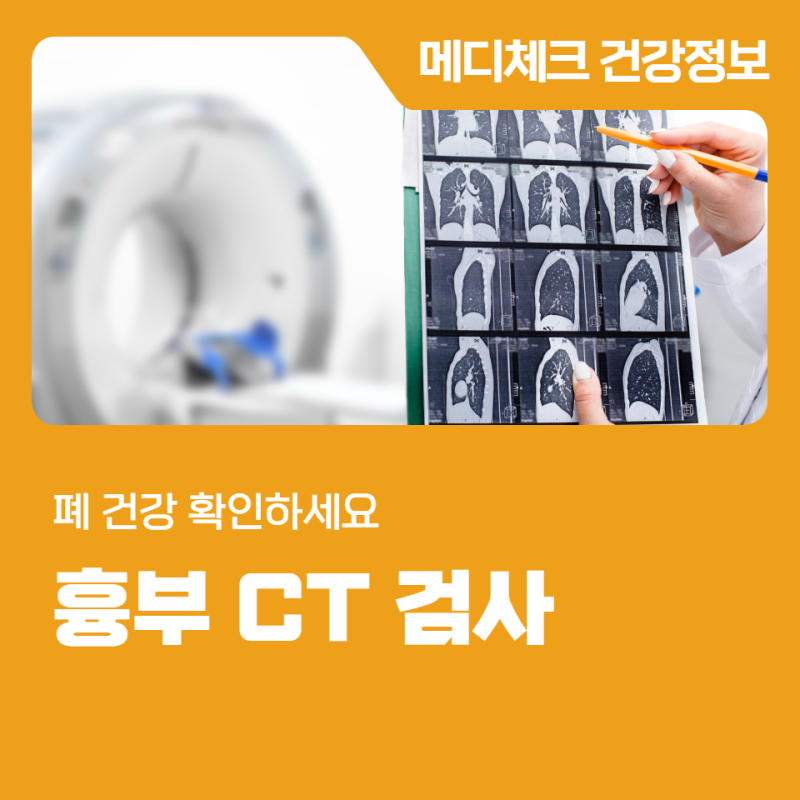 마산 흉부CT 검사로 확인하는 폐 건강