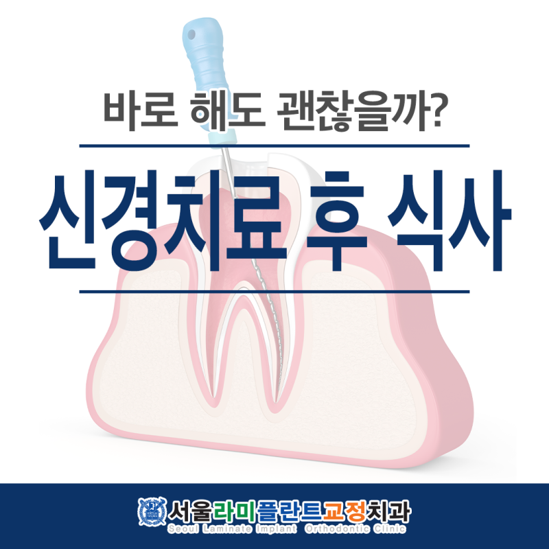 신경치료 후 식사 바로 해도 괜찮을까?