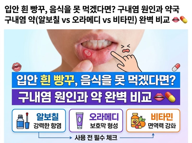 입안에 흰 빵꾸가 뚫려 음식을 못 먹겠다면? 구내염 원인과 약국 구내염 약(알보칠 vs 오라메....