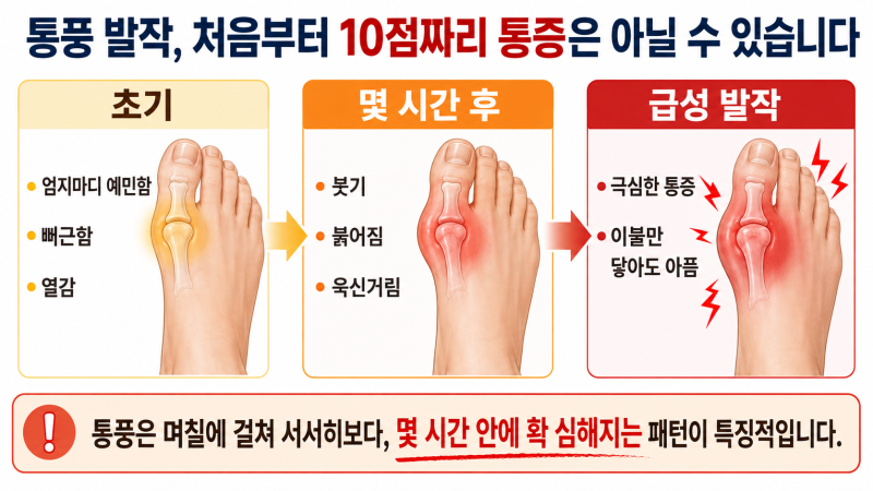 발가락 엄지마디가 불타듯 아프다? 통풍 발작 전에 놓치기 쉬운 3가지 신호