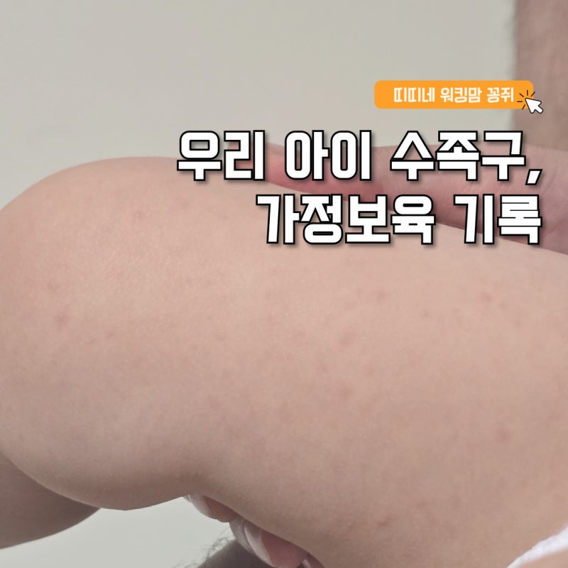 17개월 아기 수족구 증상 투병 기록, 가정보육하면서 직접 사용해본 추천템(연고)과 진단비 ....