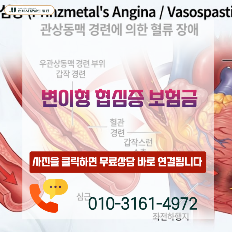 변이형 협심증 보험금, I20.1 진단받고도 지급 거절되는 이유는 무엇일까요?
