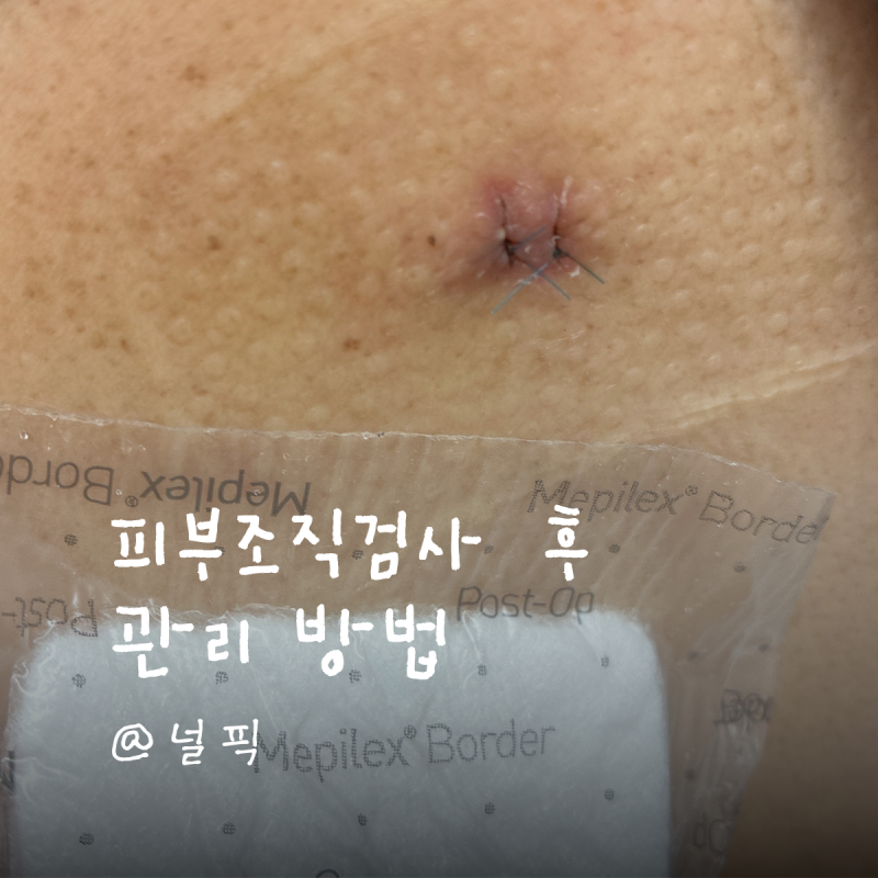 피부 조직검사 후 샤워, 운동, 술 언제부터 가능할까? 관리법 총정리