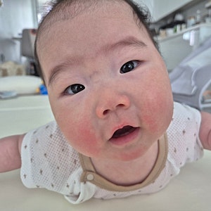 이유식 알러지 테스트 방법 시기 필수 체크리스트