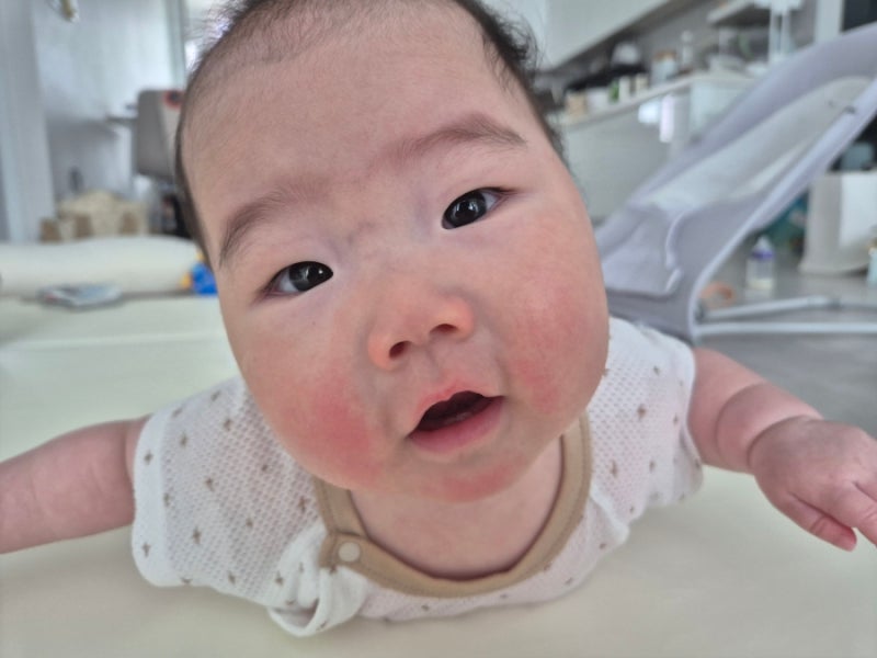 이유식 알러지 테스트 방법 시기 필수 체크리스트