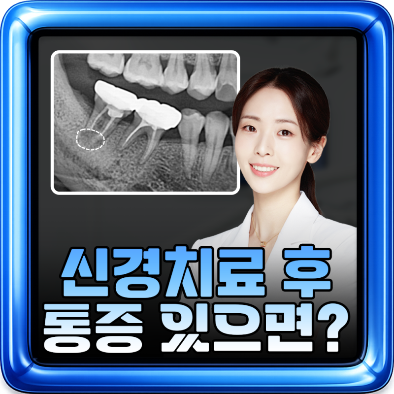 어금니 신경치료 후 통증 원인 다시 치과 가야 할까?
