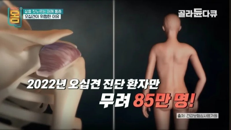 EBS 어깨 통증 완화 솔루션: 오십견, 회전근개 파열, 충돌 증후군 맞춤형 운동법